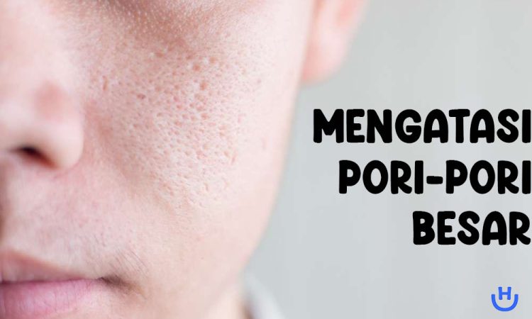 mengatasi pori-pori besar